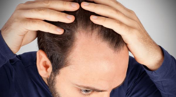 caderea parului din cauza stresului afectiunea secolului 21