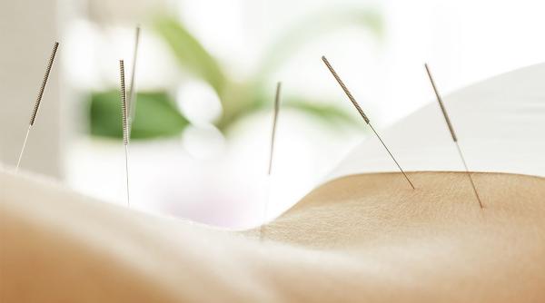 cum putem opri durerea prin acupunctura