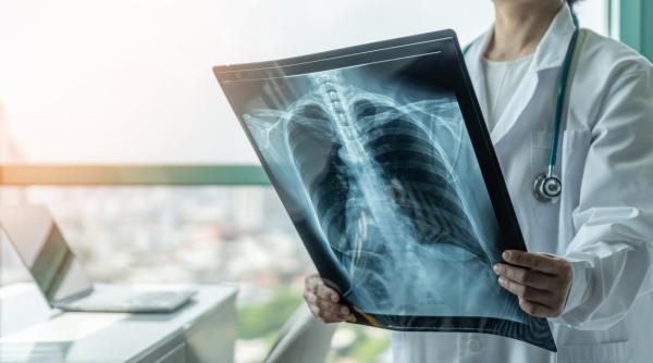 romania campioana la tbc cum vrea guvernul sa scape de tuberculoza pana in 2035