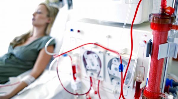reguli noi in tratarea bolnavilor care au nevoie de dializa