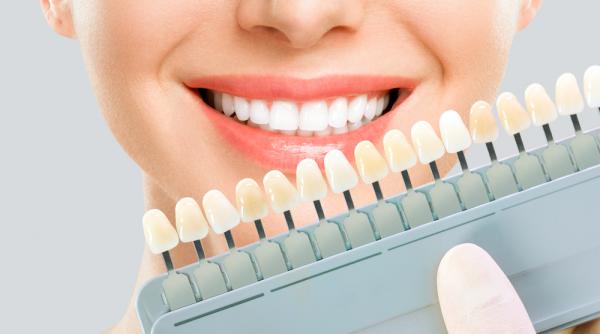 7 sfaturi pentru a pastra dantura alba fara a afecta smaltul dentar