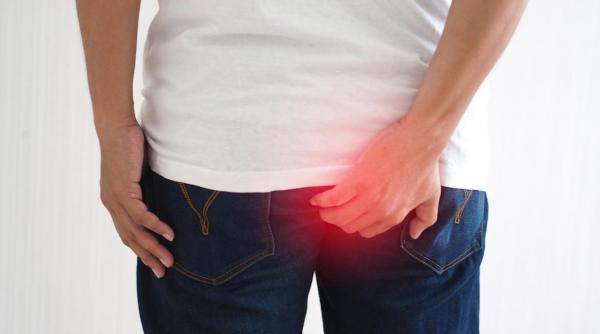 cea mai buna crema pentru hemoroizi