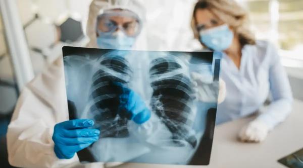 coronavirus oms avertizare varianta