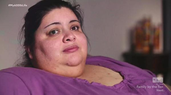 tratament obezitate adolescenti medicamente aprobate sua