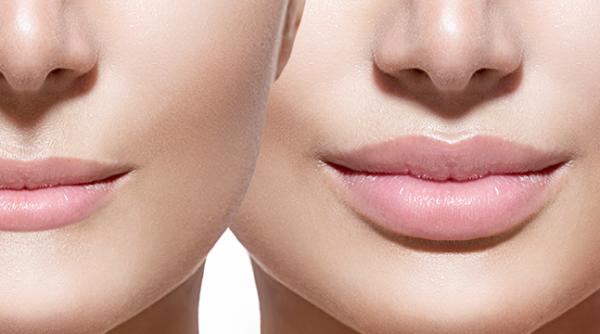 reconturare hidratare buze