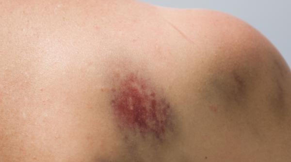 tinere batute sechestrate prostitutie italia