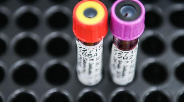 test sange scuti bolnavi cancer chimioterapie