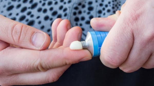 remedii pentru hemoroizi sfaturi si solutii