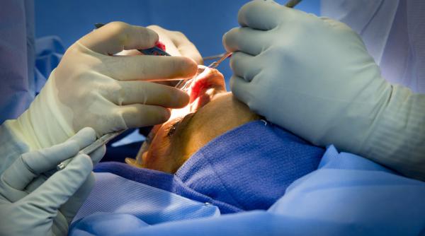 rinoplastie bucuresti vedete operatie