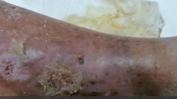 facias cere ministrului rafila corp control viermi obregia