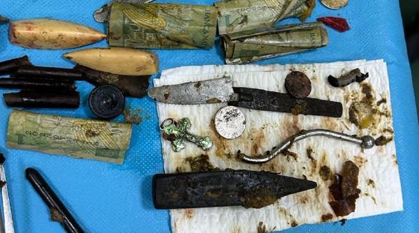 bani lama cutit lingura alte obiecte metal stomac pacient iasi