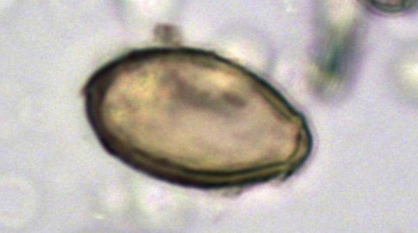 alerta sanatate china trei cazuri ciuma bubonica mongolia interioara