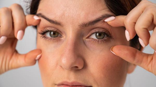 ce este blefaroplastia si cine sunt candidatii potriviti pentru interventie