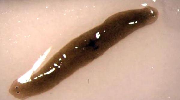 descoperire socanta gasit medicii canberra creier femeie