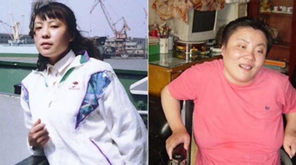 femeie otravita taliu facultate murit zeci ani invalida chinuri