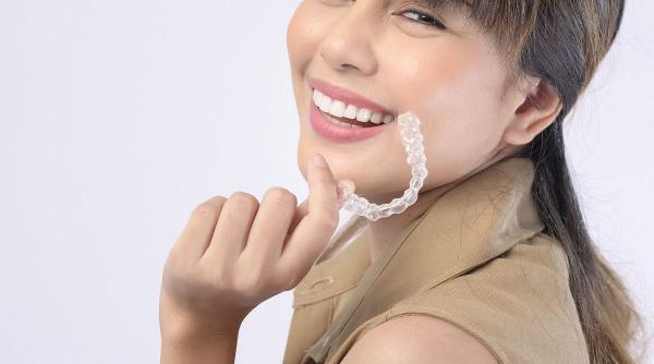 toate detaliile despre aparatul dentar invisalign pret beneficii si mod de functionare