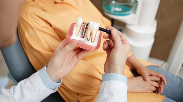 garantia implantului dentar asumarea interventiei medicale