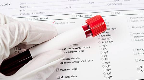 hepatita b c d infectie virala incidenta vhc