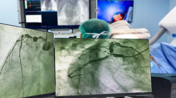 ce este angiografia coronariana si cand este indicata