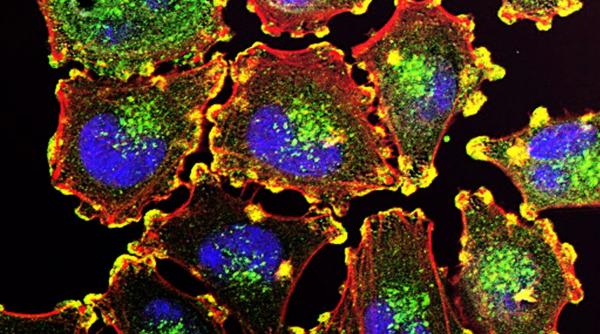 studiu alcool sapte tipuri cancer