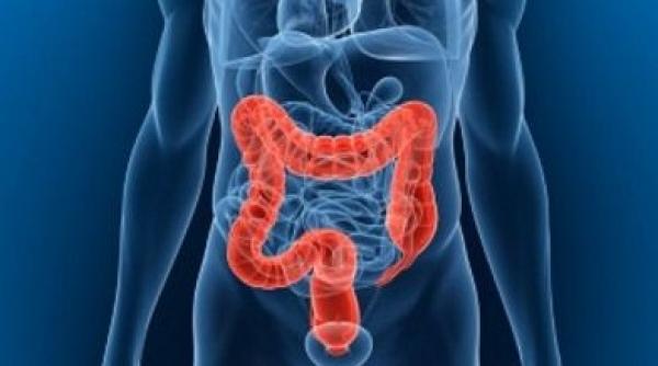 6 semne cancer colon persoane sub 50 ani