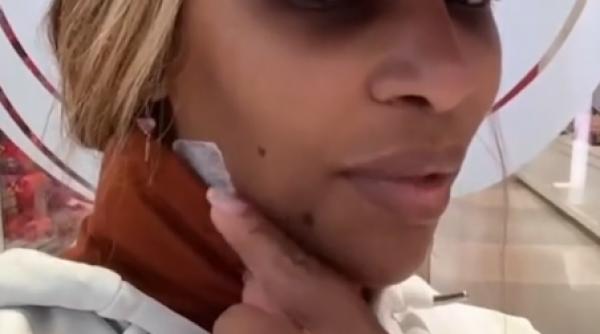 serena williams operata urgenta campioana chist urias gat