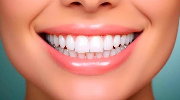 all on 4 implant procedura minune care iti reda zambetul inainte sa apuci sa te temi de dentist