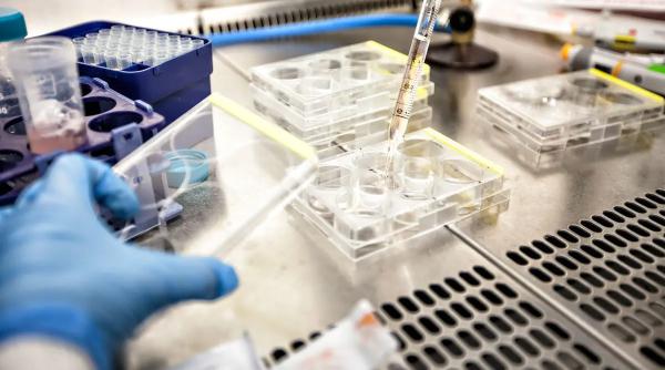 endometrioza test de saliva