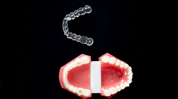 top 5 avantaje ale aparatului dentar invizibil