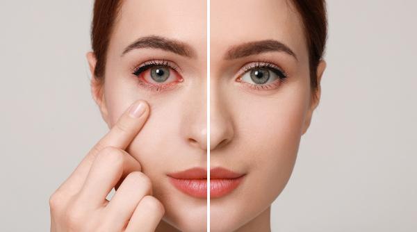 10 cele mai bune vitamine alimente sanatatea ochilor