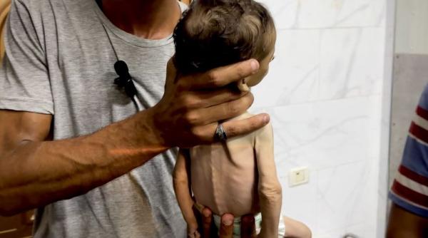 Foamete în Fâșia Gaza. Malnutriție severă la copii. Populația afectată de ordine de evacuare