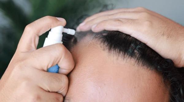 cum previi caderea parului factori principali remedii naturale