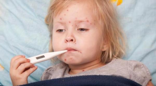Rujeola în zilele noastre, la niveluri ca acum 50 de ani. Rata de vaccinare în rândul copiilor, în scădere