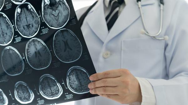 Cercetătorii britanici dau vești bune: suntem adolescenți până la 32 de ani