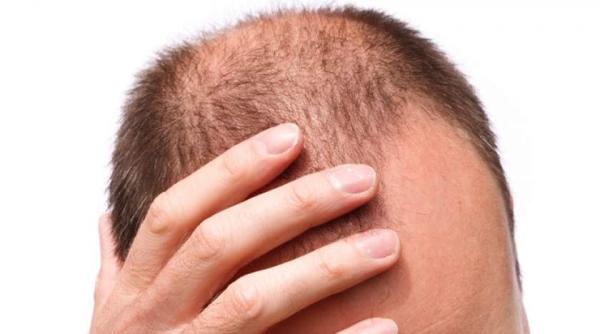 stop caderii parului 3 alimente previn pierderea podoabei capilare