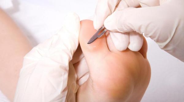 4 pasi simpli picioare perfecte trucul ieftin face minuni calcaiele tale