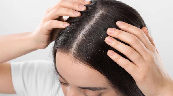 Seleniu beneficii: alege un șampon antimătreață eficient