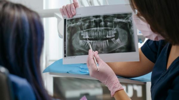 de la ce varsta se poate face un implant dentar