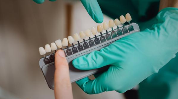 De ce materialul unei coroane dentare poate conta mai puțin decât diagnosticul la Mb Dental Cluj-Napoca