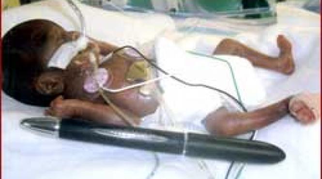 record cel mai mic bebelus din lume