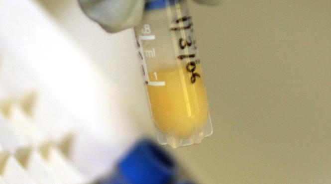 hiv se ascunde discret in stomac