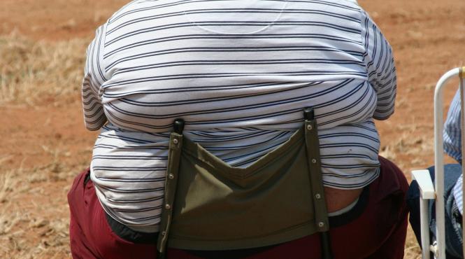 operatii pe obezi