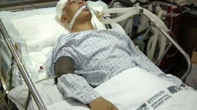 campion mondial de box deconectat de la aparatele de mentinere a vietii