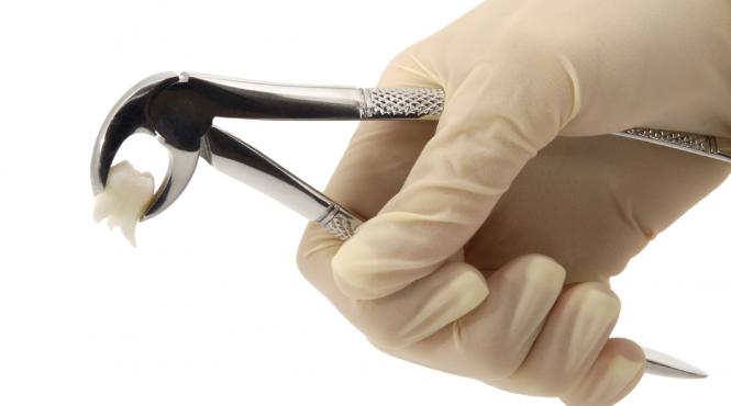 stomatologie fara durere