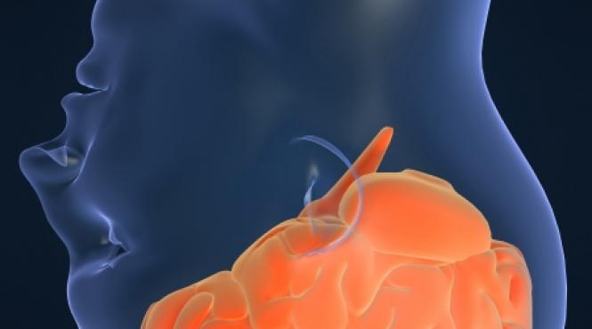 semne ce anunta avc