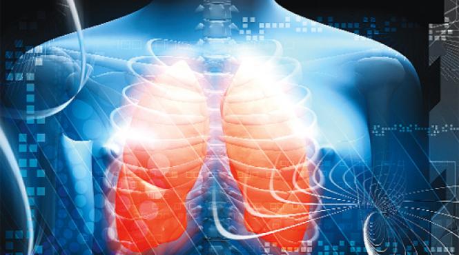 sfatul medicului pneumonia