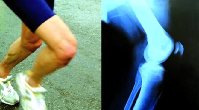 bijuteria din genunchi