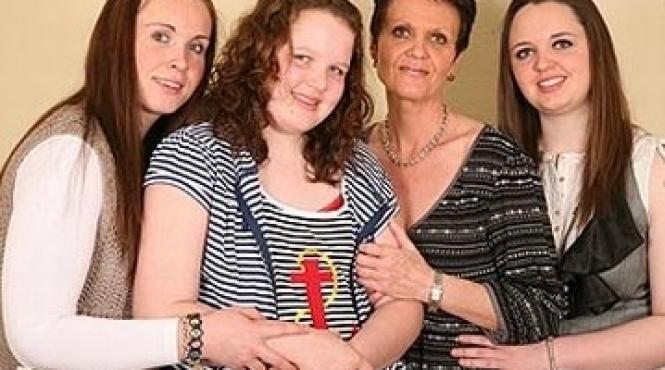 o boala genetica o transforma in statuie