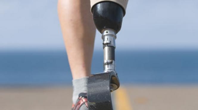 picior de plastic dar destept