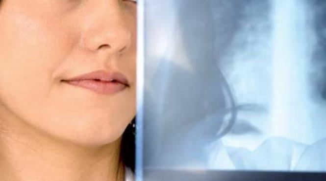 plamanii si blestemele